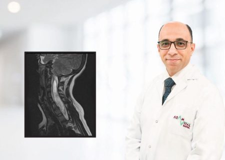 مستشفى ادم فيتال” جراحة ناجحة لحالة نادرة في العمود الفقري لطفلة ” 13 عاما