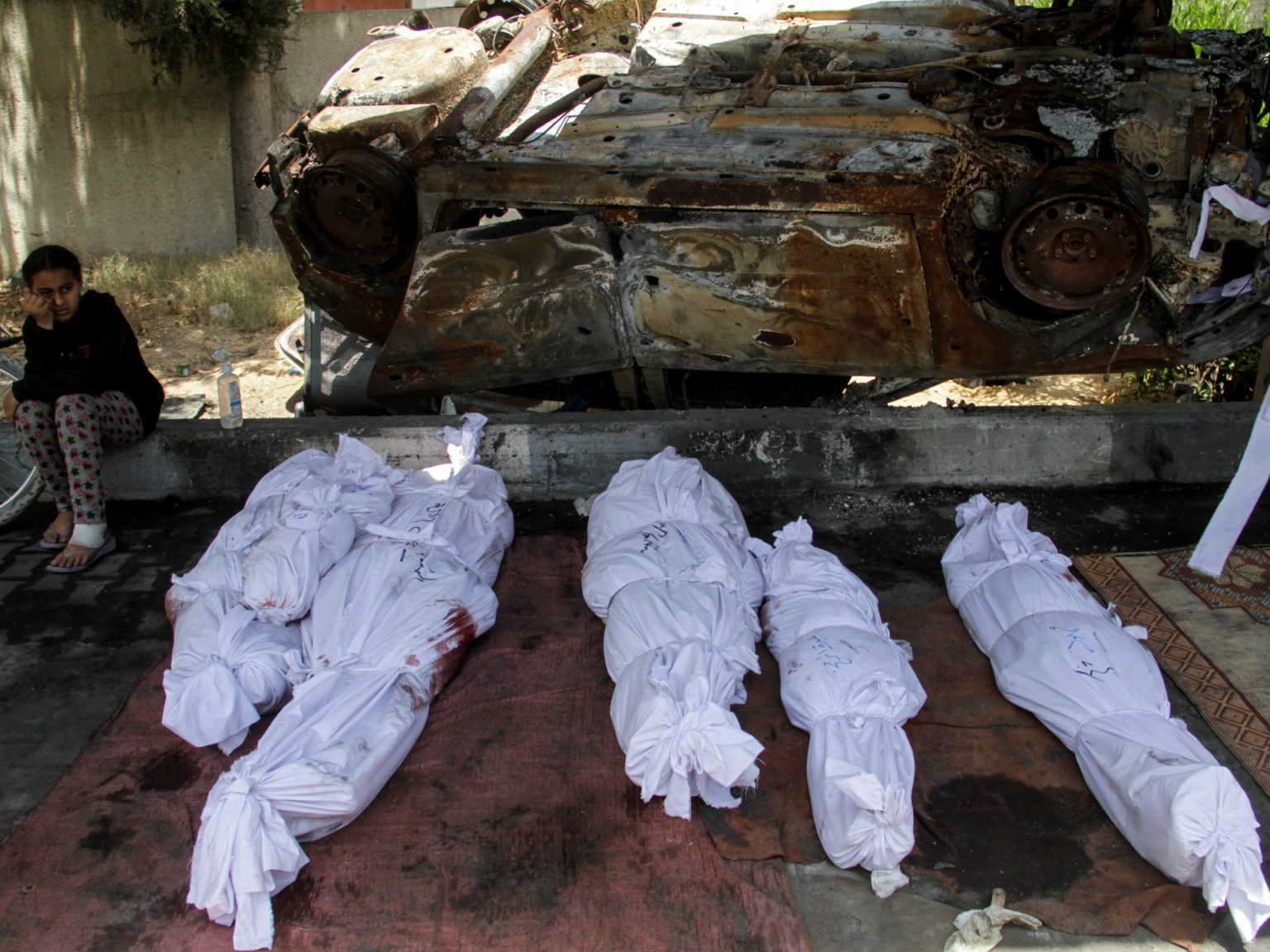 نحو 36 ألف شهيد في غزة وأكثر من 80 ألف مصاب