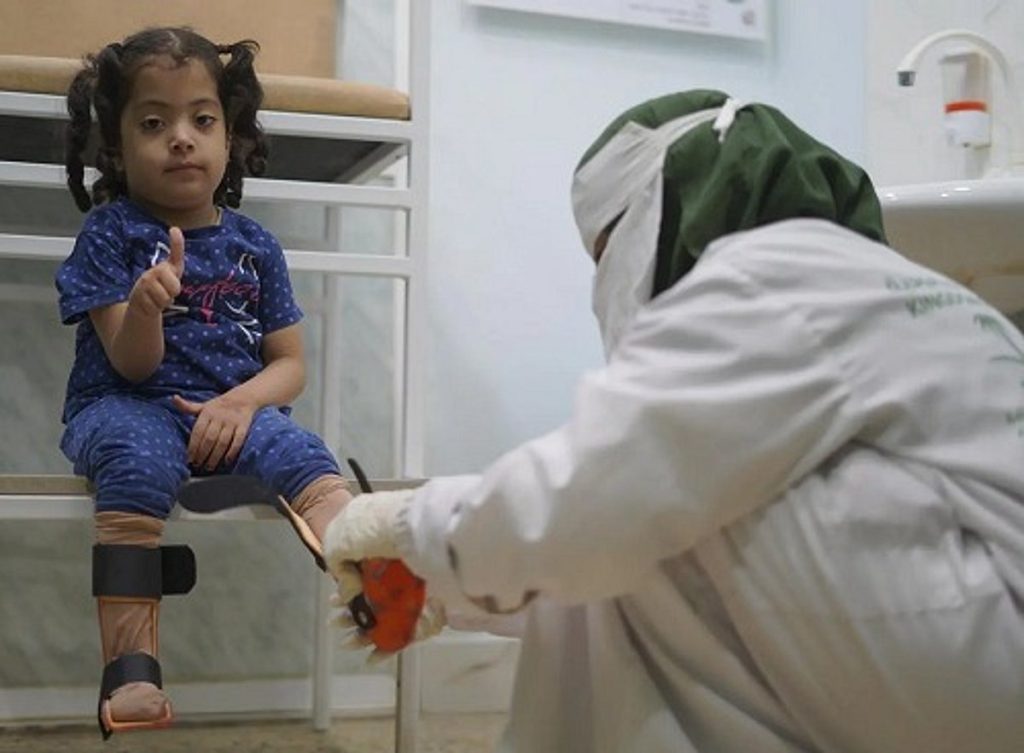 بدعم من المملكة.. مركز الأطراف الصناعية في حضرموت يُقدم خدماته لـ 775 مستفيدًا خلال مايو