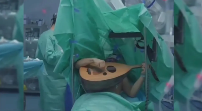 مطرب عراقي يغني ويعزف على العود خلال عملية جراحية لاستئصال ورم من دماغه ( فيديو)