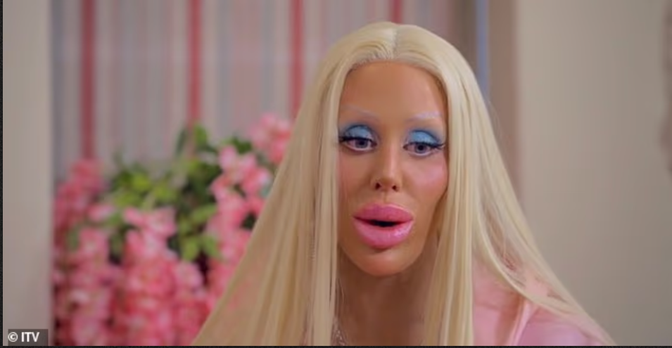 أنفقت ربع مليون على عمليات التجميل لتصبح بهذا الشكل .. فكيف كان شكلها سابقاً ؟ (شاهد الصور)