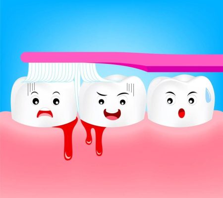 متى يكون نزيف اللثة علامة تحذير؟