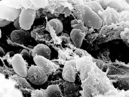 دراسة: أقدم أمراض البشرية منذ 37 ألف عام