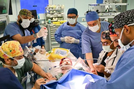 بدء عملية فصل التوأم الملتصق السعودي «يارا ولارا»