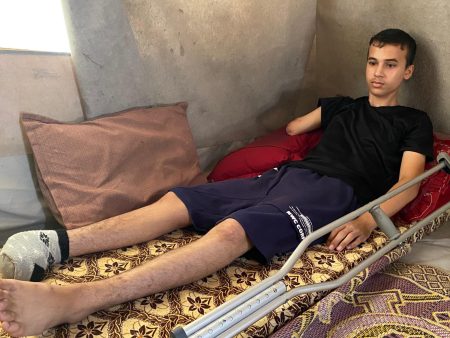 أحلام أطفال غزة مبتورة كما أطرافهم