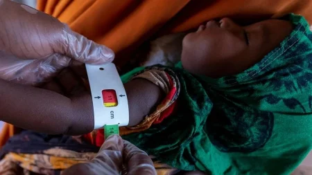 وفاة 13 طفلًا بسبب سوء التغذية في مخيم بدارفور