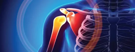 أخصائي: هشاشة العظام تؤثر على مفصل الكتف