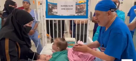 «مثل أطفالنا».. حديث مؤثر بين «الربيعة» ووالدة التوأم السيامي السوري