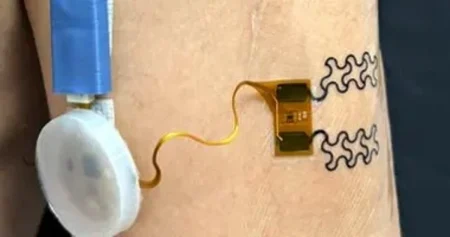 ابتكار جهاز جديد يقيس مستوى ترطيب الجسم لمنع الإصابة بضربات الشمس