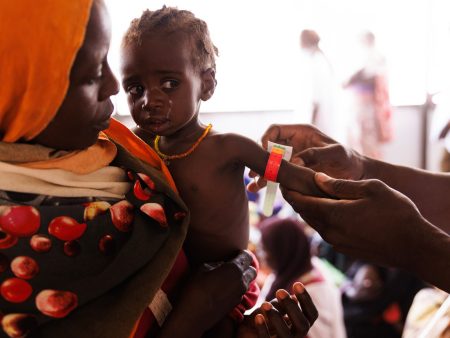 “اليونيسيف” تحذر من تفاقم سوء التغذية الحاد بين الأطفال في دارفور