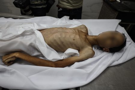 وفاة طفل جوعا بغزة وإصابة 900 ألف آخرين بسوء التغذية