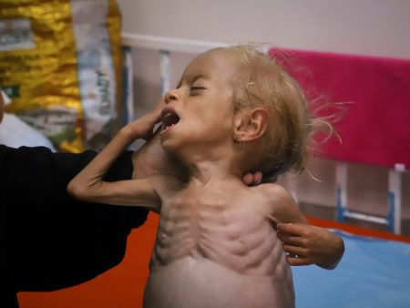 خبراء يطالبون الأمم المتحدة بمنع كارثة إنسانية أكبر بغزة