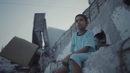 الحرب والمجاعة تزيدان من التشوهات الخلقية في غزة