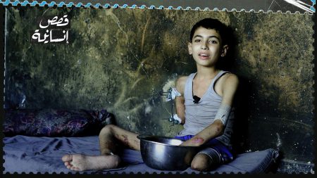 مسيّرة إسرائيلية تبتر أطراف طفل داخل غرفته في غزة