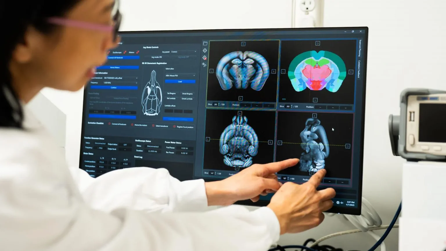 focused ultrasound brain creatine.webp