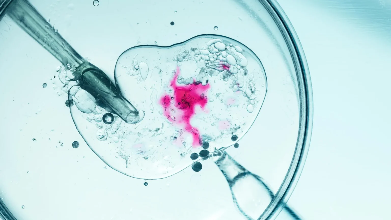 in vitro fertilization process.webp