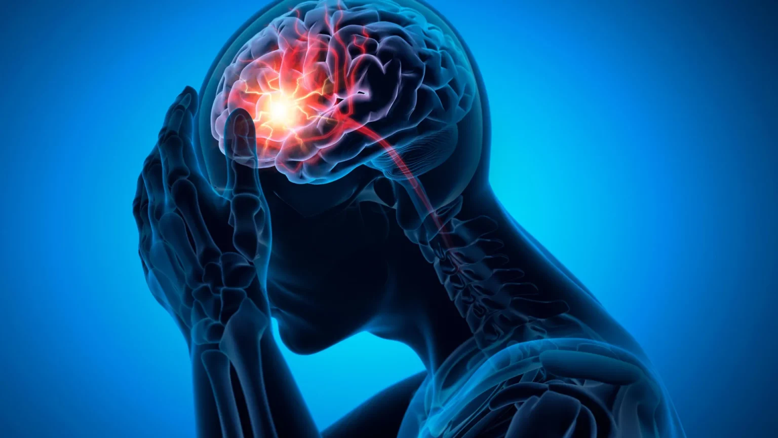 man headache brain stroke.webp