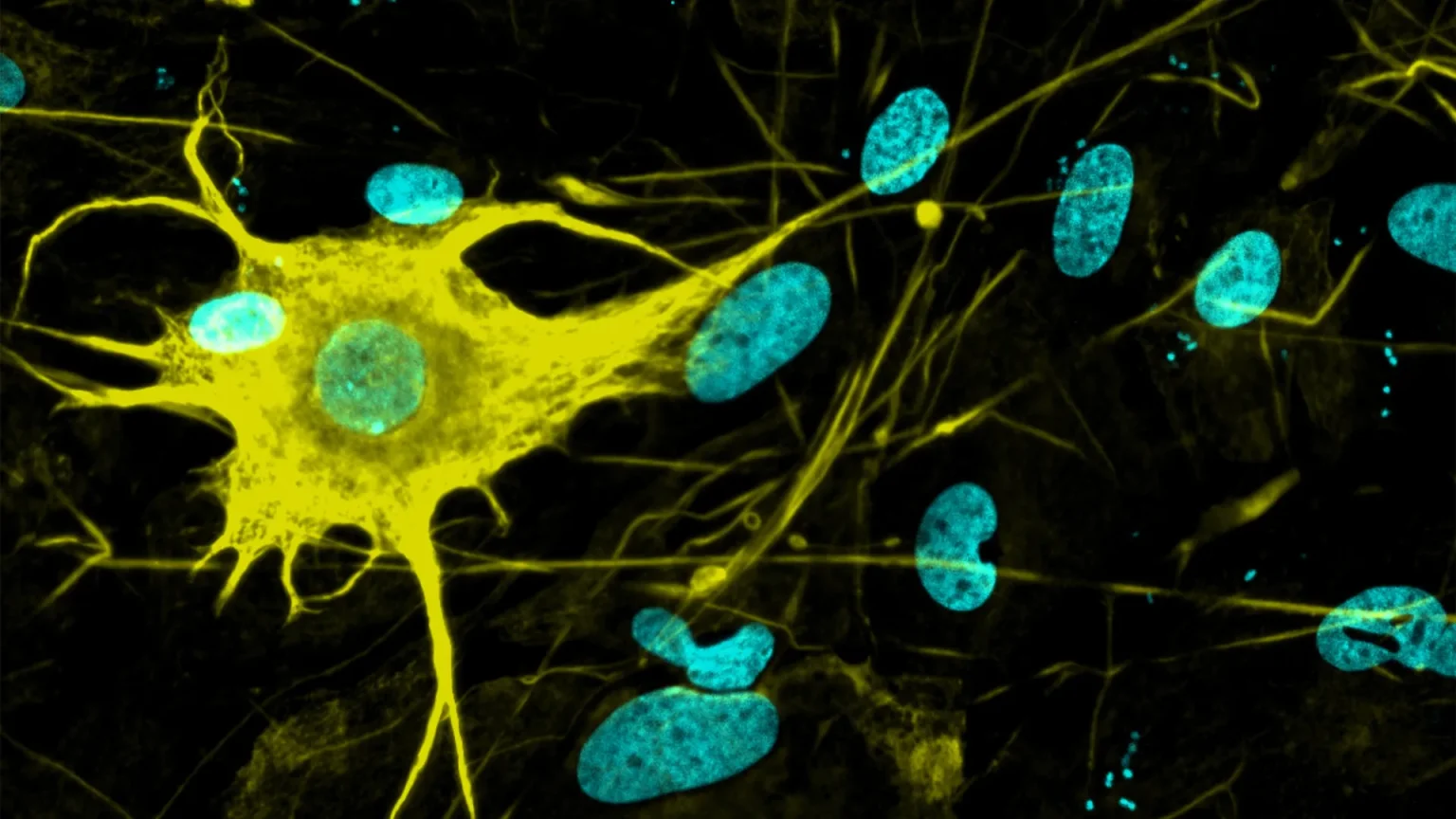 nerve cell type.webp