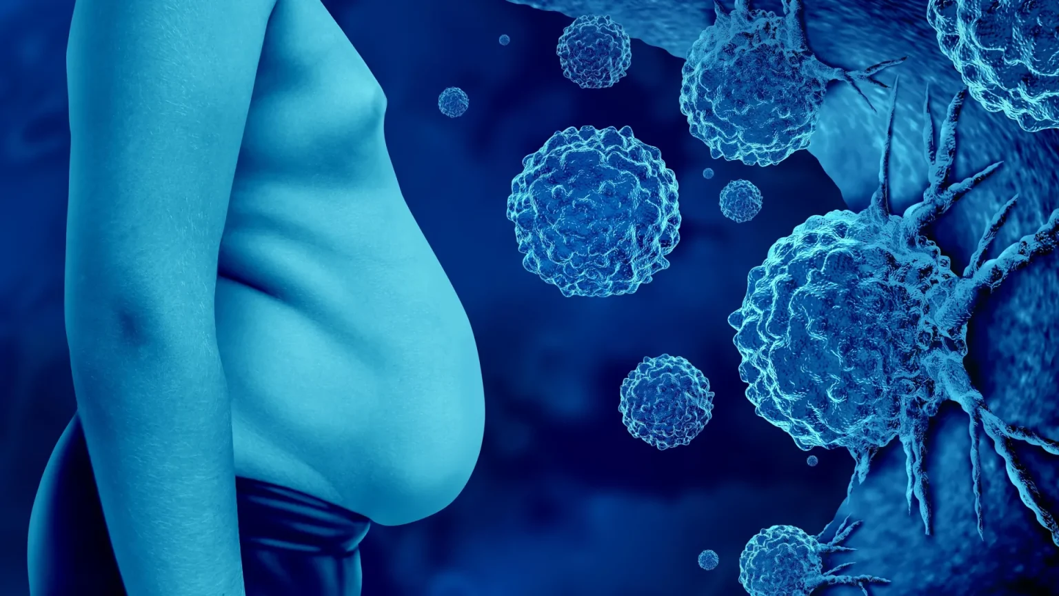 obesity belly cancer cells.webp