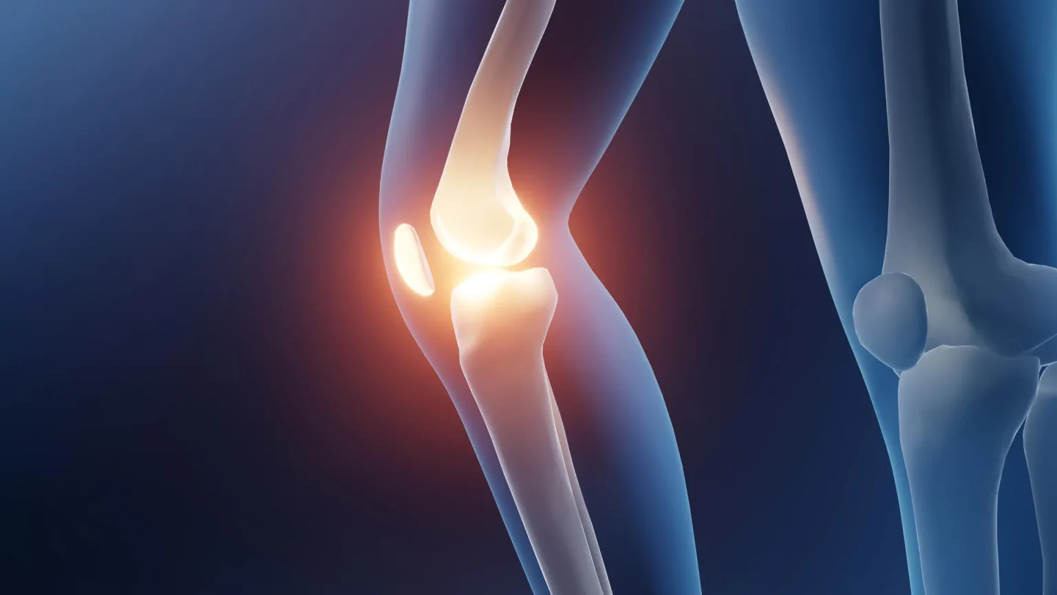 arthritic knee joint arthritis injury pain.webp