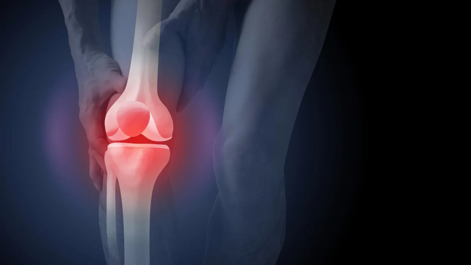 arthritis knee pain.webp