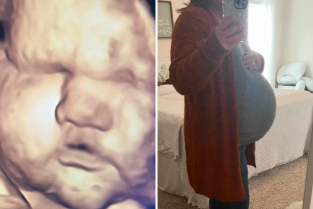 Array baby measuring big