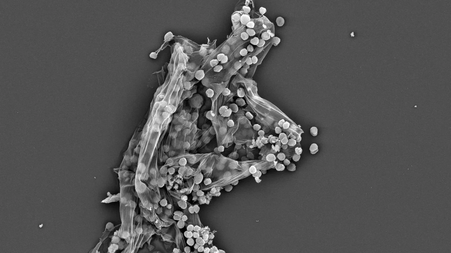 electron microscope image methanogens.webp