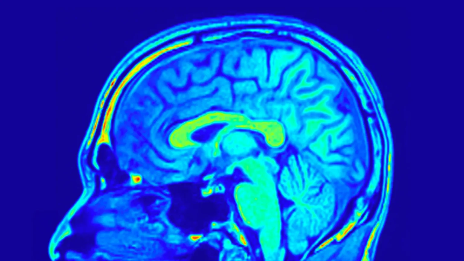 human brain mri colorful sagital slice.webp