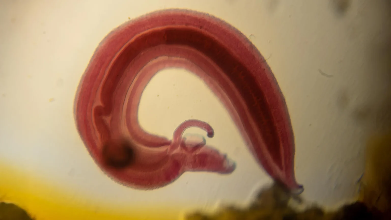 human parasitic worm.webp