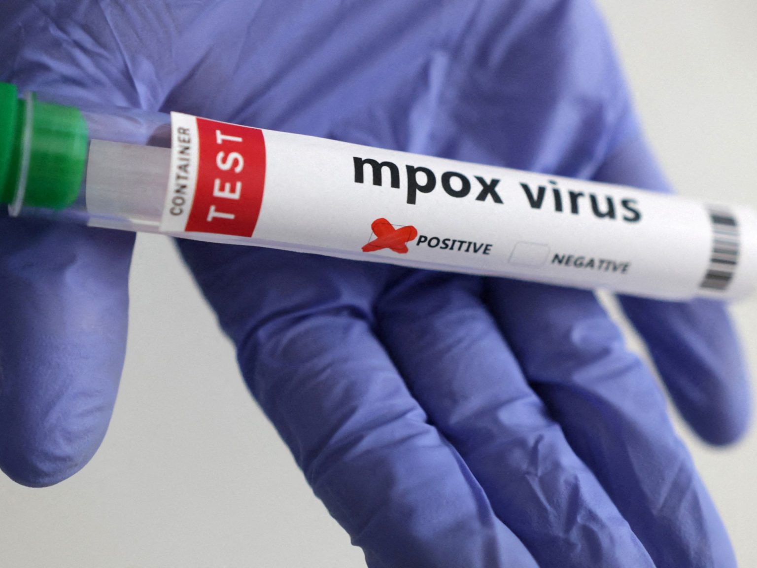 2024 10 30T151209Z 181574346 RC2PJ9APSX6D RTRMADP 3 HEALTH MPOX BRITAIN 1730403781