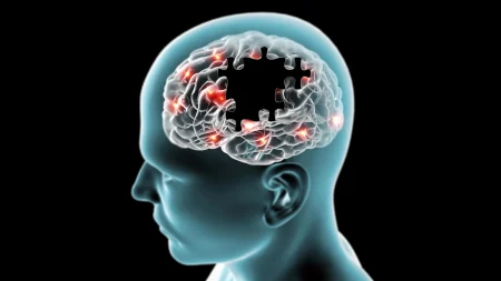 brain missing puzzle pieces degenerative diseases.webp